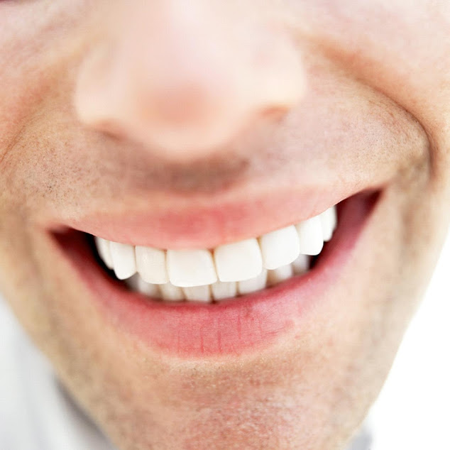man-with-white-teeth
