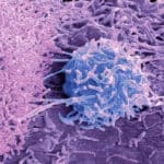 Бид үүнийг “Хорт хавдар” гэж нэрлэх шаардлагагүй байж магадгүй Бид үүнийг “Хорт хавдар” гэж нэрлэх шаардлагагүй байж магадгүй