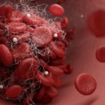 Мэргэжилтнүүд тархинд цус харвах эрсдэлийг бууруулах 8 чухал аргыг зөвлөж байна Мэргэжилтнүүд тархинд цус харвах эрсдэлийг бууруулах 8 чухал аргыг зөвлөж байна