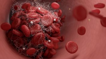 Мэргэжилтнүүд тархинд цус харвах эрсдэлийг бууруулах 8 чухал аргыг зөвлөж байна