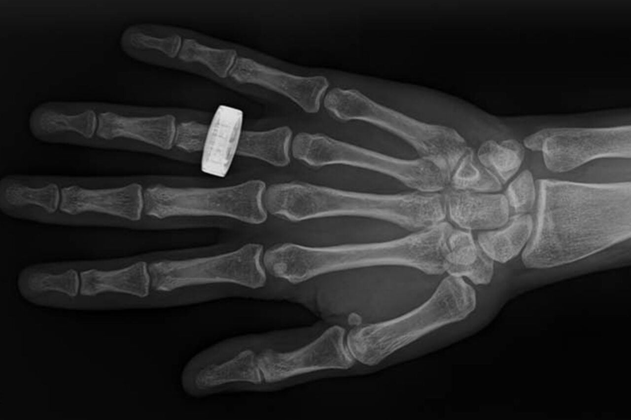 Behold: The First Medical X-rays Ever Taken in Space