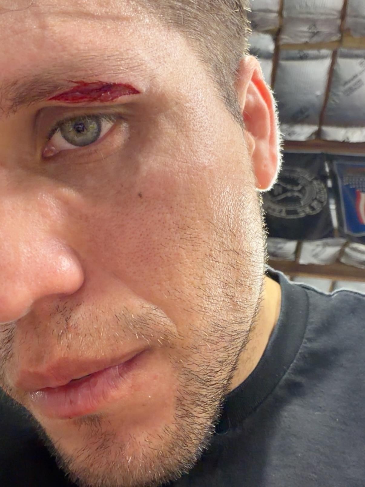 Брайан Ортега зүүн нүдний гэмтлийн улмаас UFC 331 тэмцээнийг өнжлөө